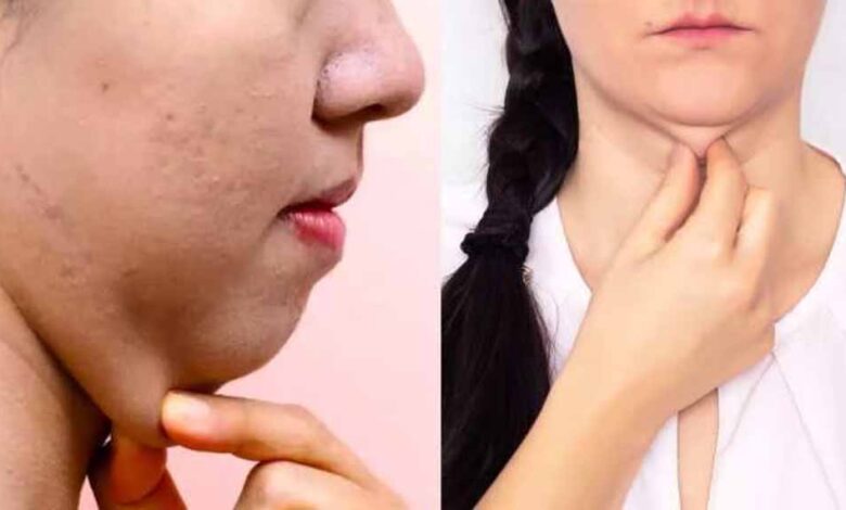 डबल चिन से छुटकारा पाने के 5 असरदार योगासन, कुछ ही दिनों में दिखेगा फर्क