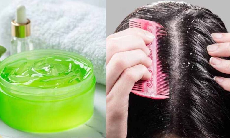 आंवला और एलोवेरा से पाएं डैंड्रफ और हेयर फॉल से छुटकारा – जानें 4 आसान तरीके
