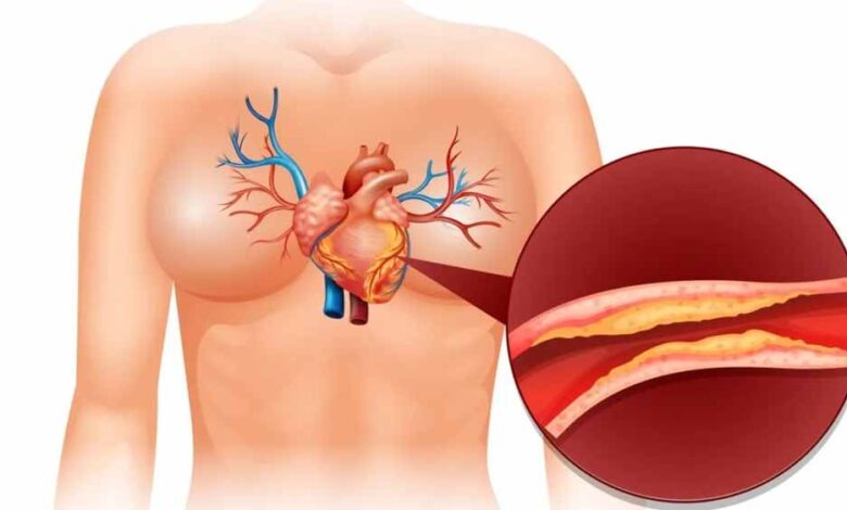कोलेस्ट्रॉल क्या है और शरीर में इसकी क्या भूमिका होती है?