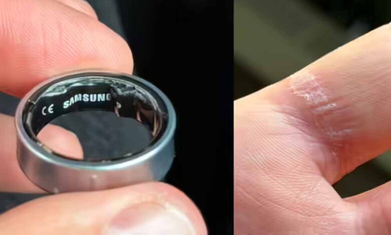 एयरपोर्ट पर रोका गया यात्री, पहुंचा अस्पताल – Khabar Jagat