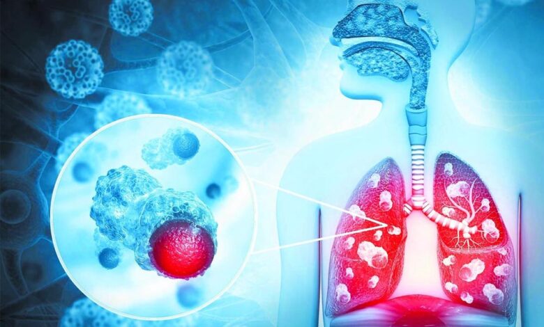 हर 9 में से 1 भारतीय को कैंसर का खतरा, पुरुषों में फेफड़े और महिलाओं में ब्रेस्ट कैंसर सबसे ज्यादा