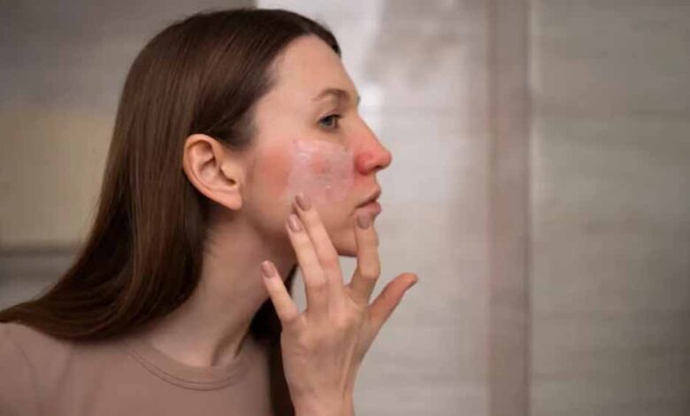 स्किन पर दिखते हैं विटामिन-D की कमी के 5 संकेत, हल्की समस्या समझकर न करें अनदेखा