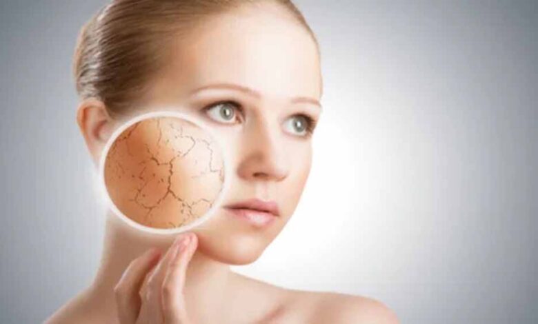 सर्दियों में फटी स्किन से परेशान? अपनाएं ये आसान घरेलू नुस्खे, मिनटों में दिखेगा असर