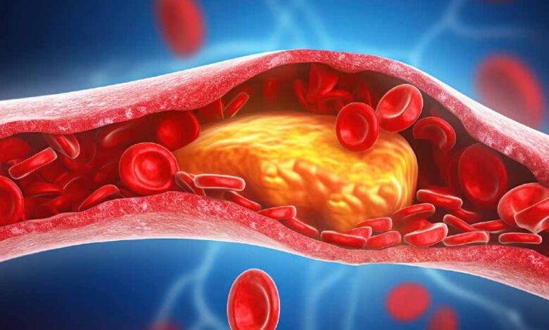 बाहर से हेल्दी, अंदर से खतरा? जानें हाई कोलेस्ट्रॉल के 5 छुपे लक्षण