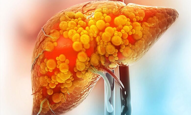 आइसक्रीम और च्युइंग गम खा रहे हैं? नई स्टडी में पता चला, ये लिवर के लिए हानिकारक